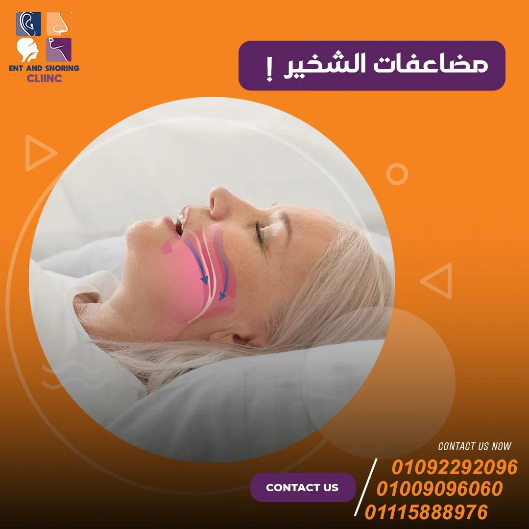 مضاعفات الشخير