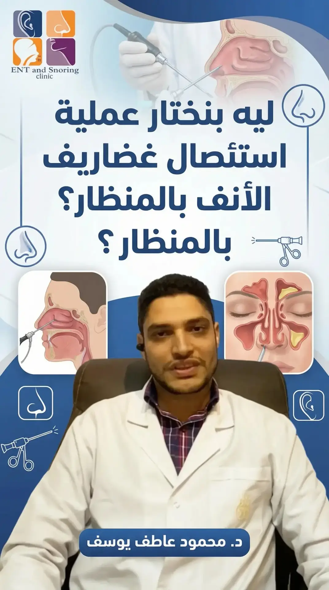 ليه تختار عملية استئصال غضاريف الأنف بالمنظار؟