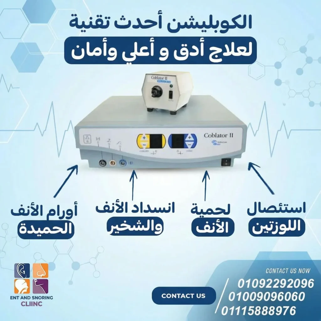 استئصال اللوزتين جهاز التردد الحراري او الكوبليشن