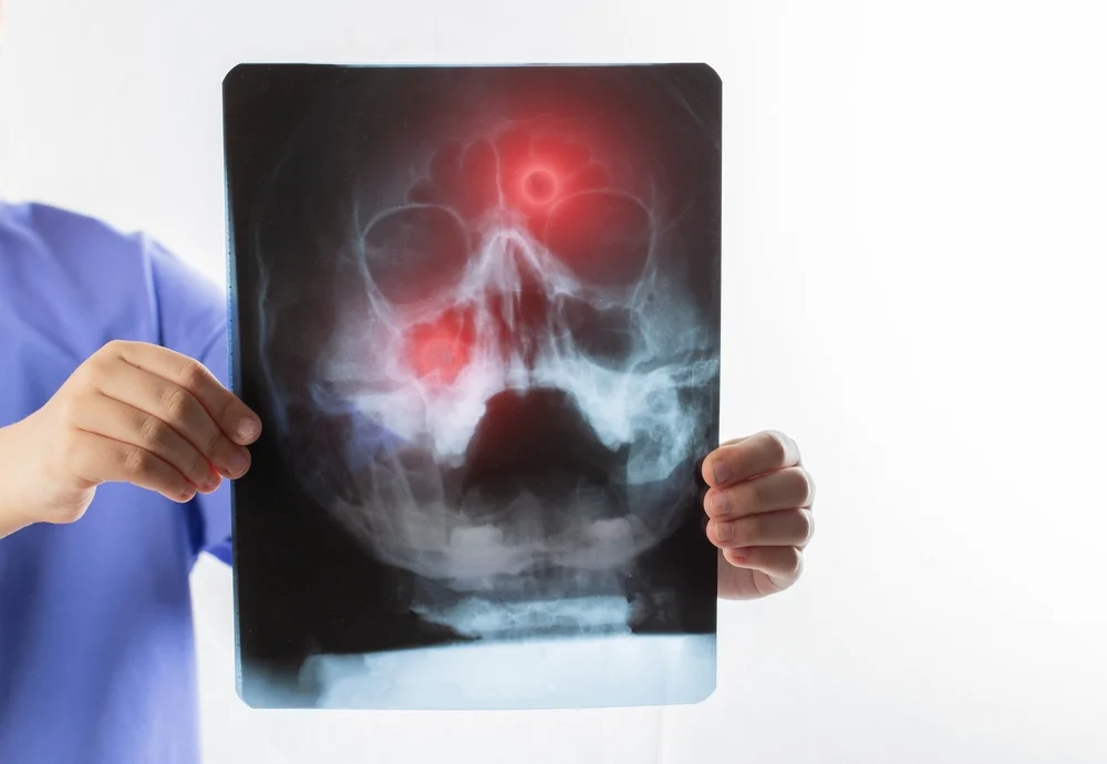 اللحمية عند الأطفال – امتي اعمل العملية؟