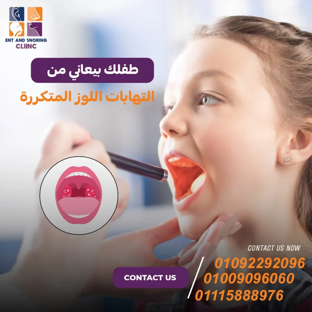 التهابات اللوز المتكررة عند الأطفال