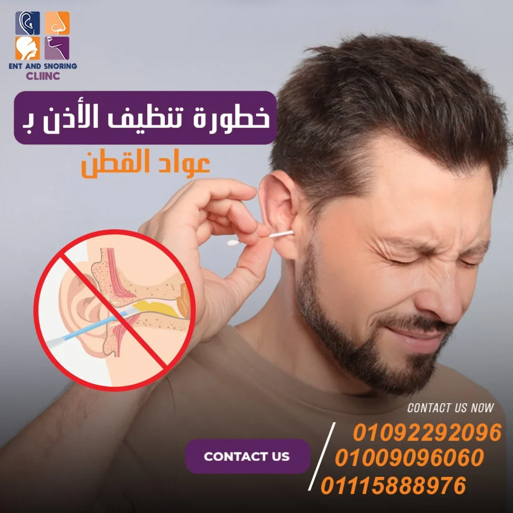 خطورة تنظيف الأذن – باعواد القطن