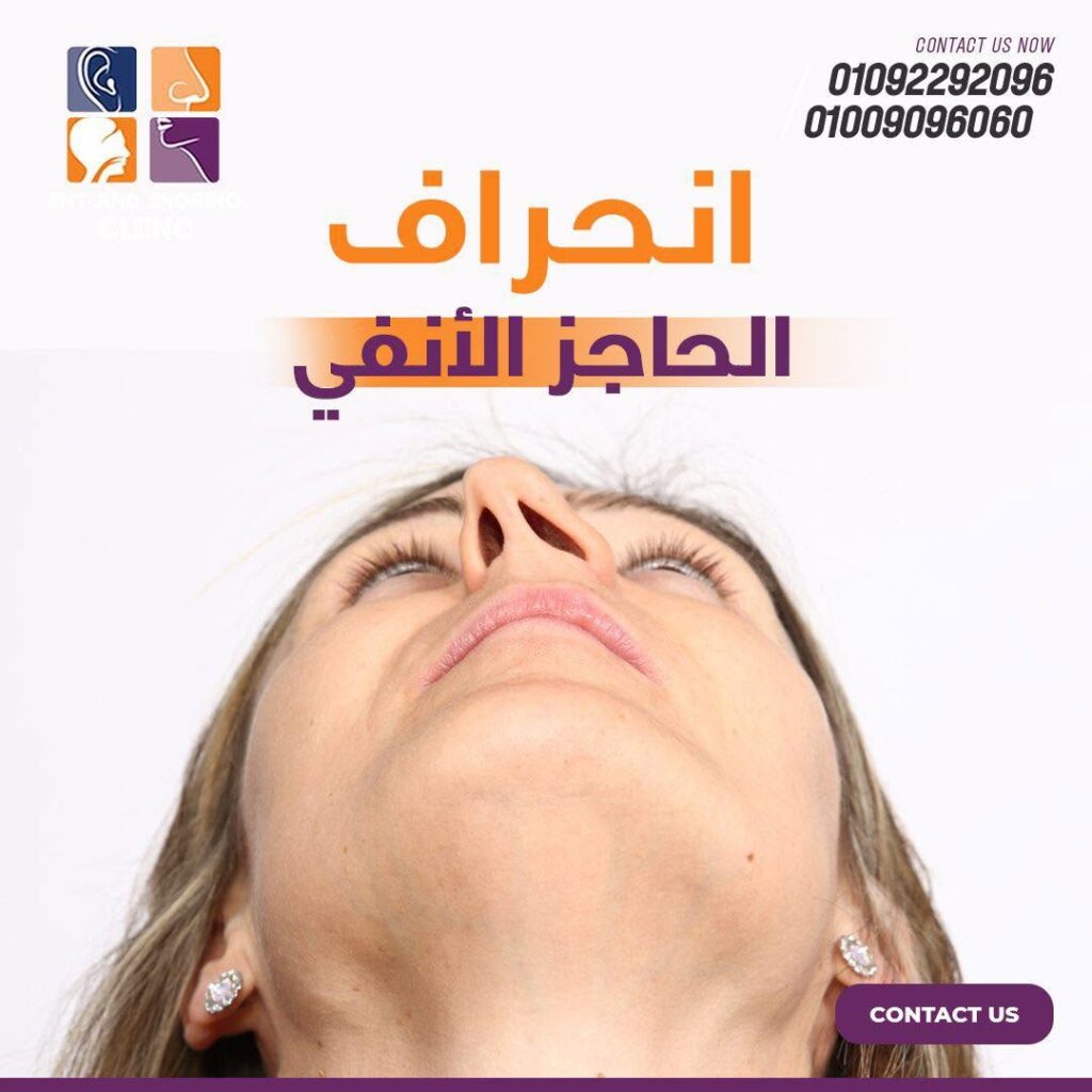 علاج انحراف الحاجز الأنفي بالمنظار