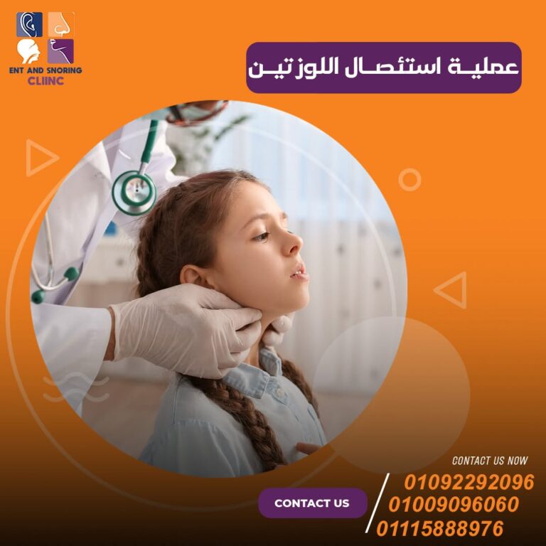 تكلفة عملية اللوزتين