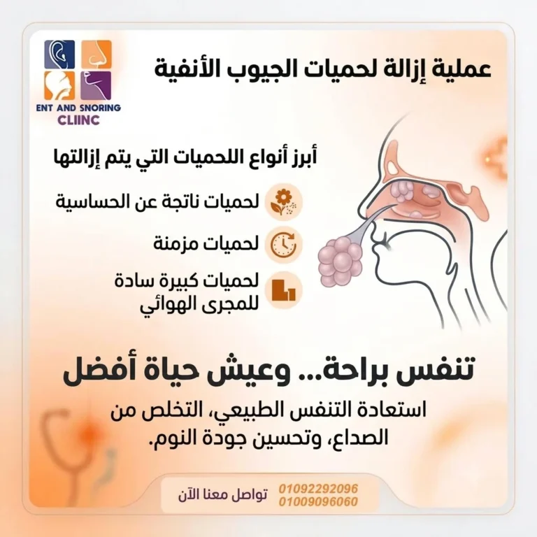 عملية ازالة لحميات الجيوب الأنفية