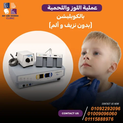عملية اللوز واللحمية بالكوبليشن (بدون نزيف و ألم)
